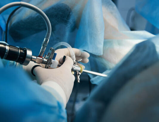 Close up photo of a medical worker in latex gloves standing with a hysteroscope near the patient